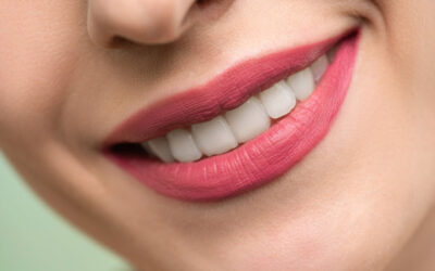 Smile Makeover Options: From Whitening to Veneers